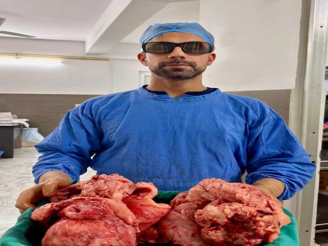 Fibroid laparoscopic surgery mandav hospital