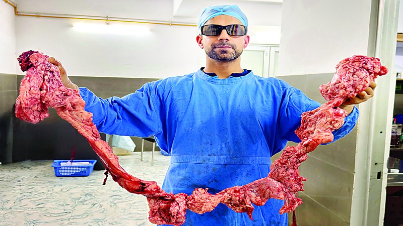 Fibroid laparoscopic surgery mandav hospital